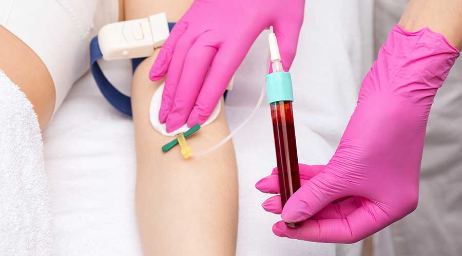 Liệu pháp huyết tương giàu tiểu cầu sử dụng máu tự thân nên hoàn toàn tương thích, an toàn và mang hiệu quả nhanh