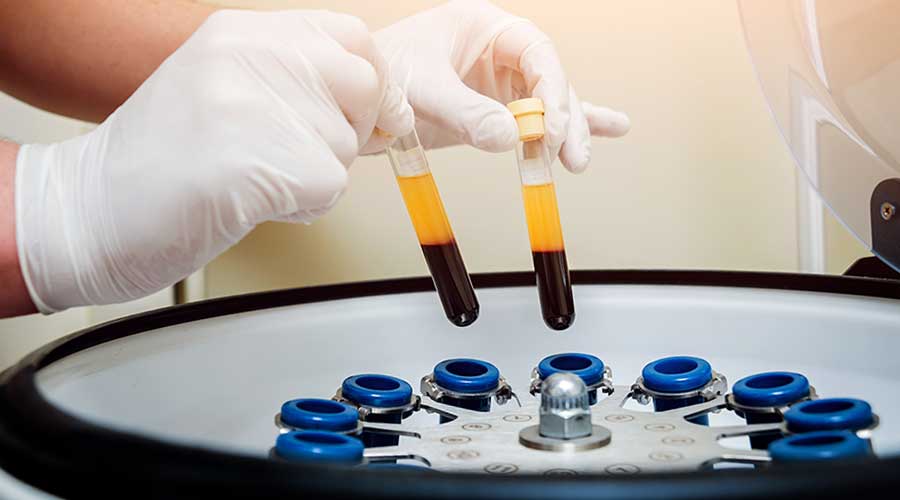 Liệu pháp cấy máu tự thân được đánh giá cao về tính tương thích, độ an toàn và hiệu quả điều trị