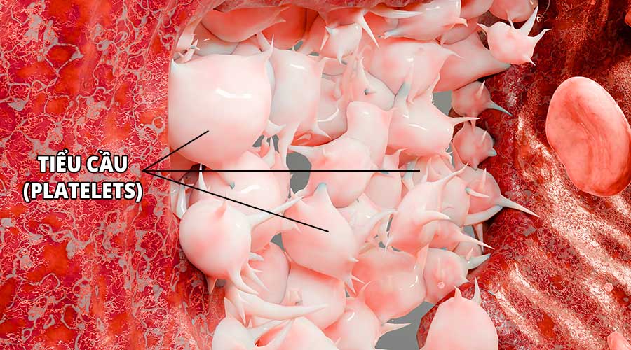 Tiểu cầu là các tế bào máu không màu, không có nhân và được sinh ra từ mẫu tiểu cầu trưởng thành trong tủy xương