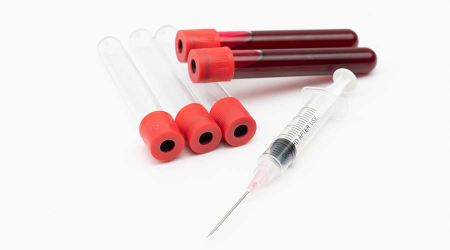 Kit PRP (PRP Kit) là bộ dụng cụ bao gồm nhiều trang thiết bị được dùng trong quy trình ứng dụng cấy máu tự thân PRP - Huyết tương giàu tiểu cầu