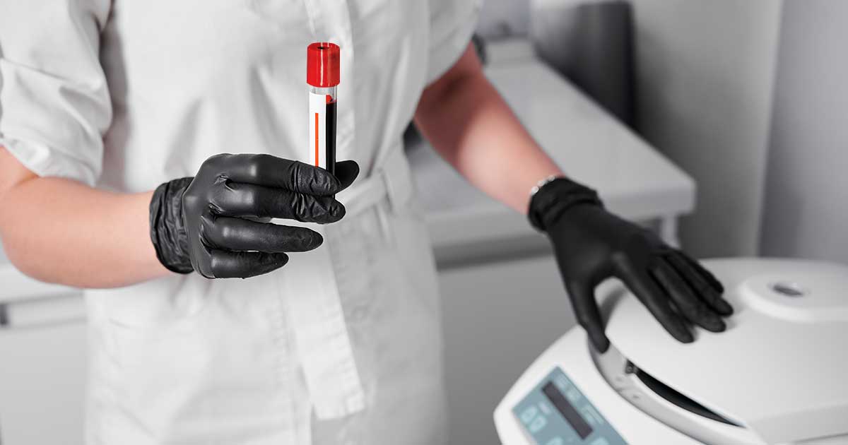 Quy trình tách huyết tương giàu tiểu cầu PRP chuẩn
