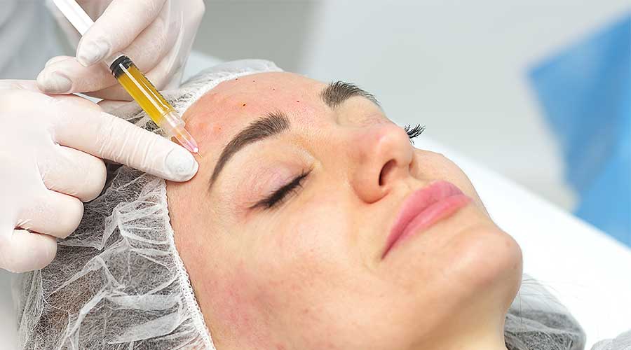Ứng dụng liệu pháp PRP trong phục hồi, chăm sóc, trẻ hóa da khá phổ biến hiện nay
