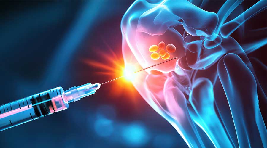 Kết hợp PRP và Tế bào gốc một cách khoa học có thể giúp tăng cường hiệu quả tái tạo, phục hồi tổn thương hiệu quả hơn