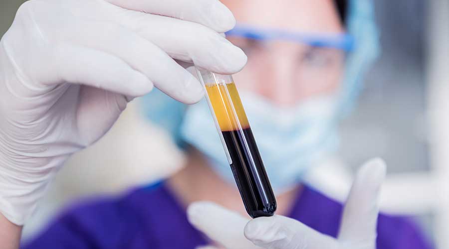 PRP không phải là Tế bào gốc và cũng không chứa Tế bào gốc