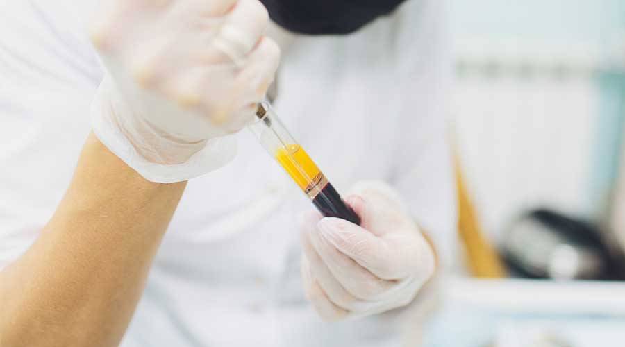 Tuy không mang giá trị cao như Huyết tương giàu tiểu cầu nhưng Huyết tương nghèo tiểu cầu vẫn có tiềm năng nhất định