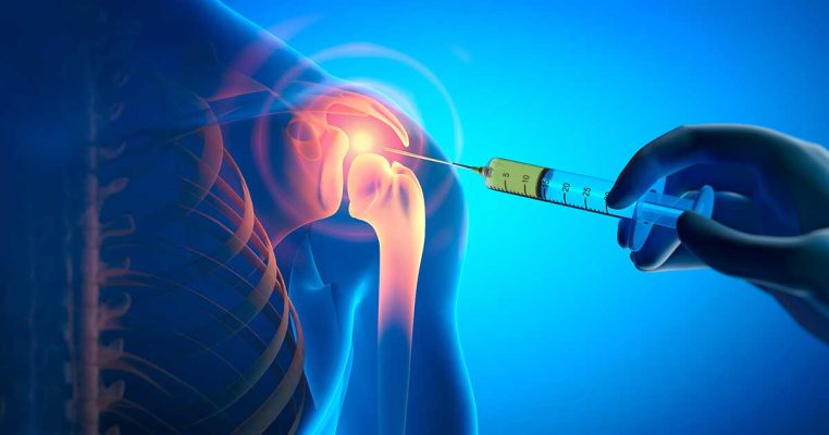 Tiêm PRP khớp vai giúp phục hồi vận động hiệu quả