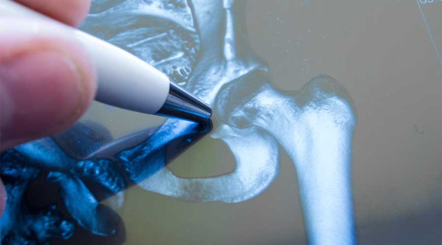 Đây là liệu trình điều trị thường được các bác sĩ cân nhắc thực hiện trong một số tổn thương khớp ở mức độ từ nhẹ đến trung bình