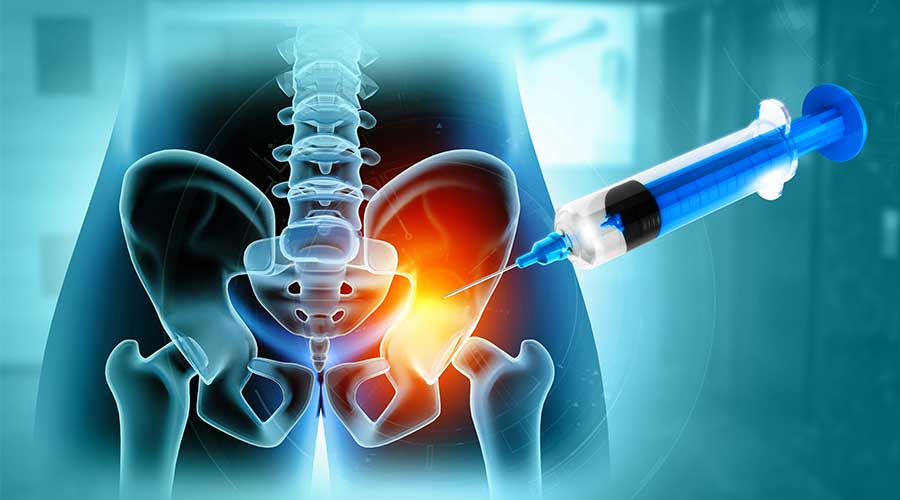 Tiêm PRP khớp háng là phương pháp đưa Huyết tương giàu tiểu cầu vào vùng khớp háng bị tổn thương nhằm kích thích quá trình tái tạo tự nhiên của cơ thể